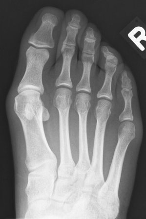 Dr. med. Konrad Scheuerer Orthopäde Fußchirurgie München