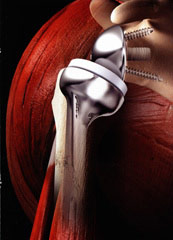 Dr. med. Konrad Scheuerer Orthopäde Unfallchirurgie München