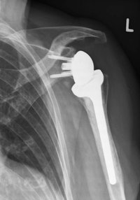 Dr. med. Konrad Scheuerer Orthopäde Schulterchirurgie München