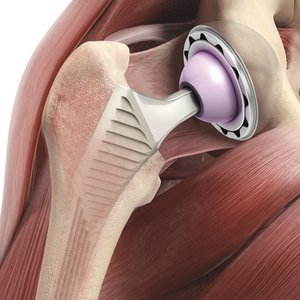 Orthopäde. Orthopädie Unfallchirurgie in München